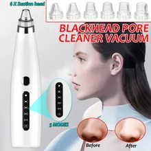Уход за кожей лица, носа, прыщей, черных точек, электрический пылесос для удаления черных точек, пористая кожа, инструменты для ухода за кожей, машина с 6 головками