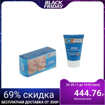 

"Before and After" whitening cream, 100 ml 2542541