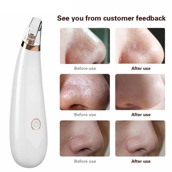 

Face Nose Acne Blackhead Removal Blackhead Vacuum Cleaner Pores Blackhead Skin Care Machine Tool