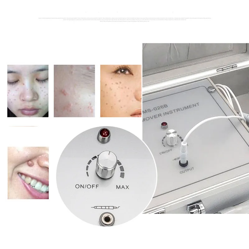 https://ae01.alicdn.com/kf/H2d6f5541b8664a47aaf8ebb3f0a4267dQ/220V-Remove-Spot-Beauty-Equipment-HOT-Electronic-Mole-Removal-Tattoo-Removal-Plasma-Pen-Laser-Facial-Freckle.jpg