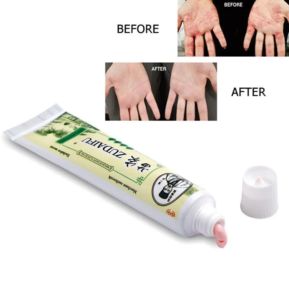 

Zudaifu Body Cream Without Retail Box Men Women Skin Care Product Relieve Psoriasis Dermatitis Eczema Pruritus Effect