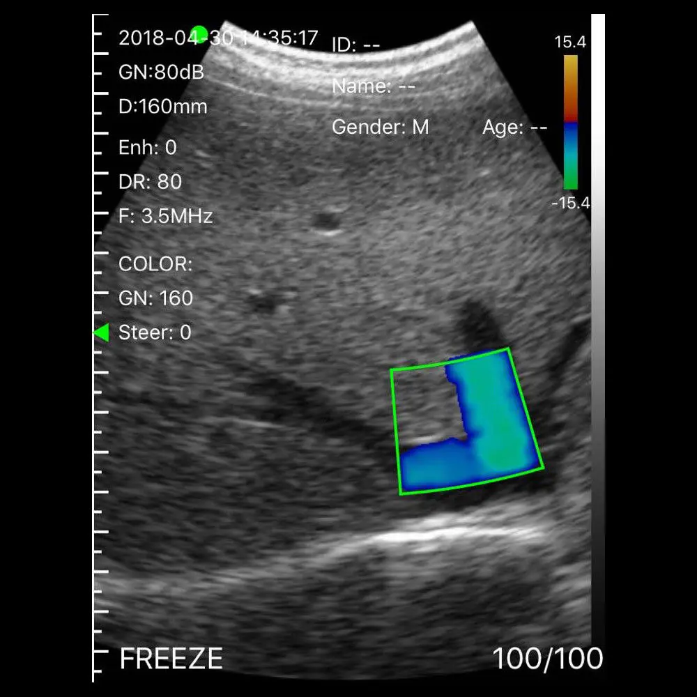 100pcs/lot D10 TWS Bluetooth 5.0 Earphone Stereo