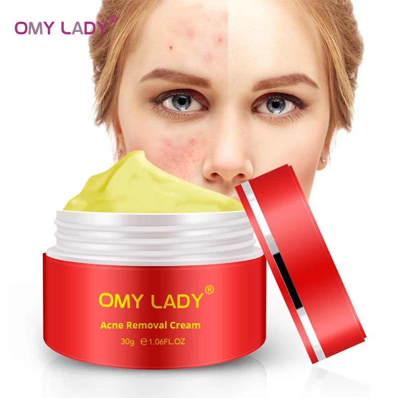 

OMY LADY Powerful Multi Effect extract Cream Eliminates wrinkles Remove Acne Scar treatment acne Anti aging Face Care gel