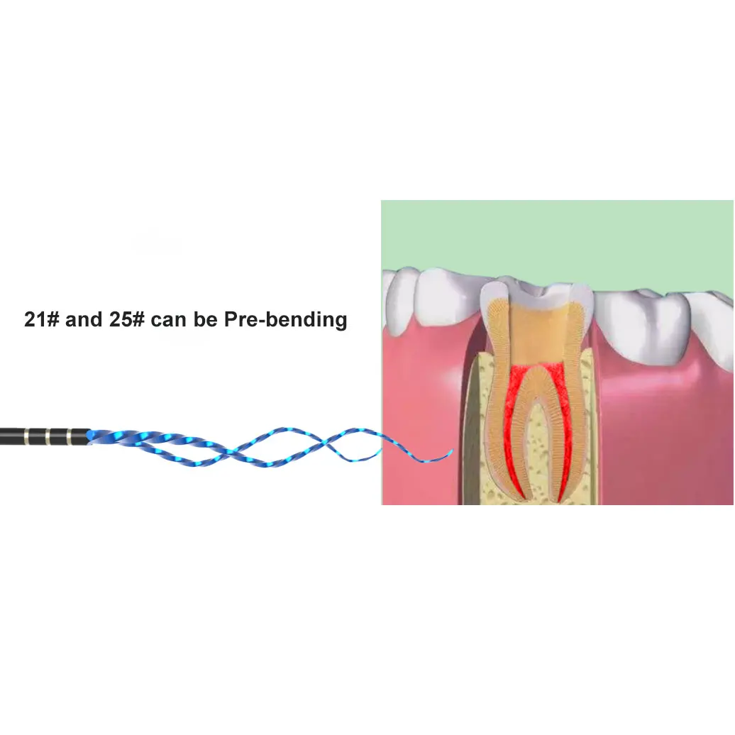 10 Paquets De Limes Endodontiques Rotatives Pro Gold - Taper SX à F3 - 21/25/31 Mm
