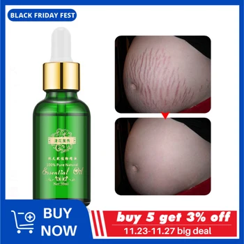 

Stretch Marks Remover Essential Oil Skin Care Treatment Cream For Stretch Mark Removal Maternity Slackline For Pregnant Oils