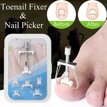 

1 Set Embed Toenail Correction Toenail Fixer Pedicure Lifter Physical Correction Stainless Ingrown Toe Nail Pedicure Recover