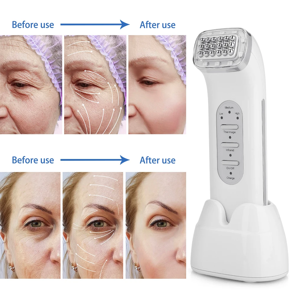 RF Radio Frequency Facial Lifting Machine Wrinkle Removal Face Lifting Skin Tightening SPA RF Radio