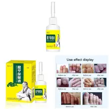 15 мл лечение грибков ногтей Удаление онихомикоза против грибка Уход за ногтями восстанавливающая жидкость WSH99