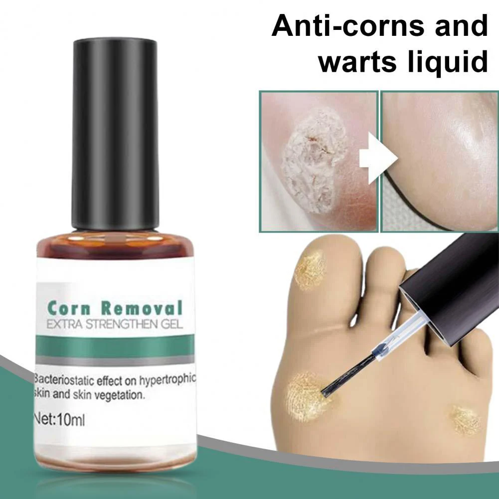 Wart Removal Serum Painless Effective Skin Tag Wart Corn Callus