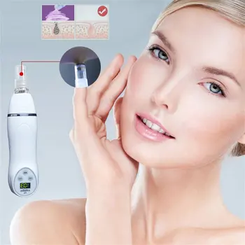 

Suction Black Equipment Cleansing Instrument Home To Blackhead Tools Blackhead Derived Pore Cleaner Artifact White