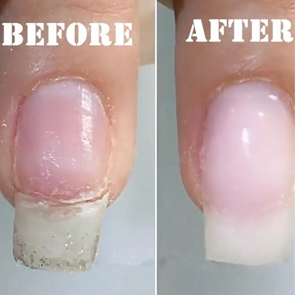 5 мл УФ-гель для наращивания ногтей из стекловолокна Гель-лак для ремонта сломанных ногтей гель безопасность и естественность клея для ногтей