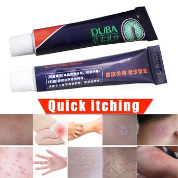 

High Quality Body Psoriasis Cream Perfect for Dermatitis and Eczema Pruritus Psoriasis Ointment Herbal Creams Tube MD88