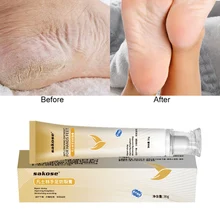 Крем для ног и рук, увлажняющий, против высыхания, гладкие тонкие линии, Осветляющий тон кожи, крем для рук