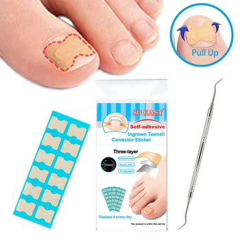 

Foot Care Tool Ingrown Nail Correction Kit Ingrown Toenail Stickers & Lifter Straightening Treatment Recover Corrector Toe Nail