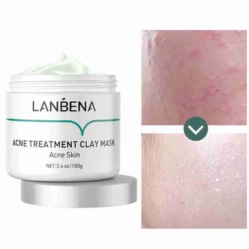 

Oligopeptide Acne Mask Mud Acne Treatment Clay Mask Deep Cleansing Remove Chronic Acnes Grease Completely Oil Control Cleansing