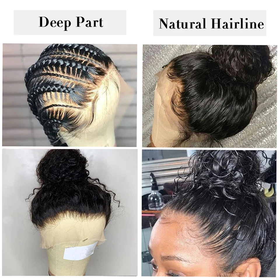 natural-hairline