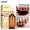 Herbal Fungal Nail Treatment Essential oil Hand and Foot Whitening Toe Nail Fungus Removal Infection Feet Care Polish Nail Gel ► Photo 1/6