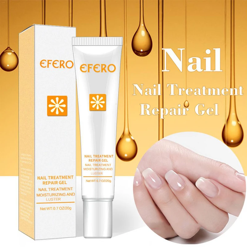 Nail Treatment Repair Cream Chinese Herbal Skin Care Nail Fungus Nails Repair Onychomycosis Paronychia Anti Naturally Treatment Nail Treatment Repair Cream Chinese Herbal Skin Care Nail Fungus Nails Repair Onychomycosis Paronychia Anti Naturally Treatment