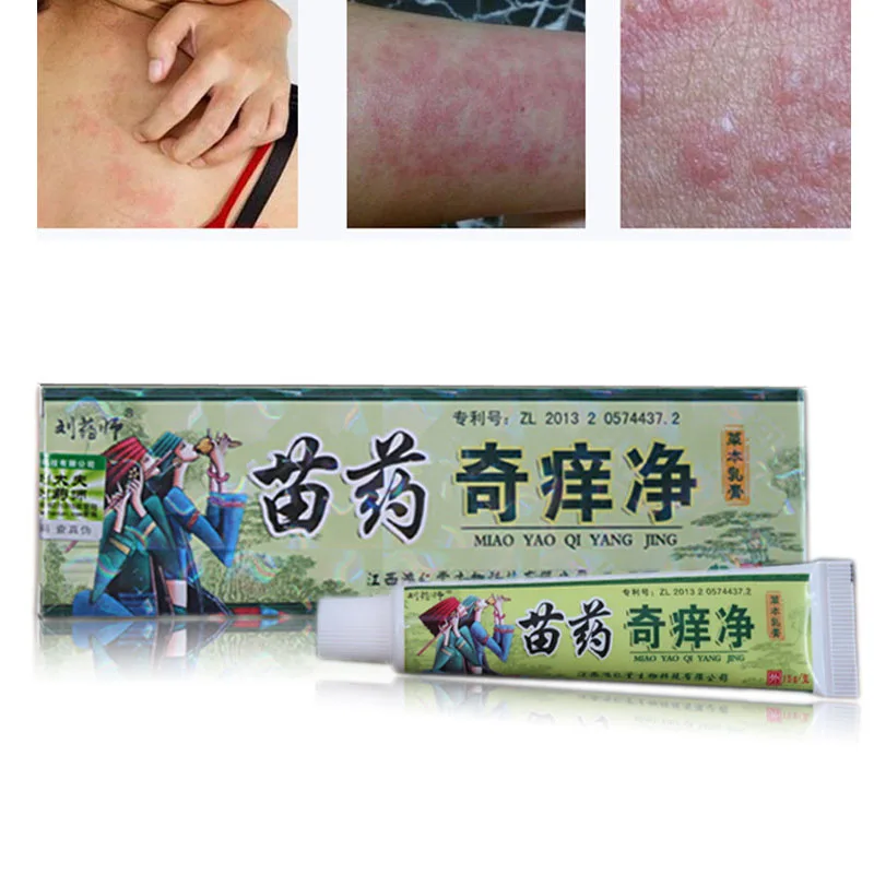 20 шт. Zudaifu крем для ухода за кожей кожа крем от псориаза дерматит Eczematoid Eczema мазь лечение крем от псориаза