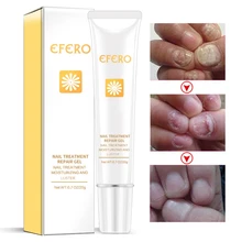 Efero грибковая обработка ногтей Уход за ногами отбеливающая эссенция для ног гель для удаления грибка ногтей против инфекции онихомикоз ремонт ногтей Es