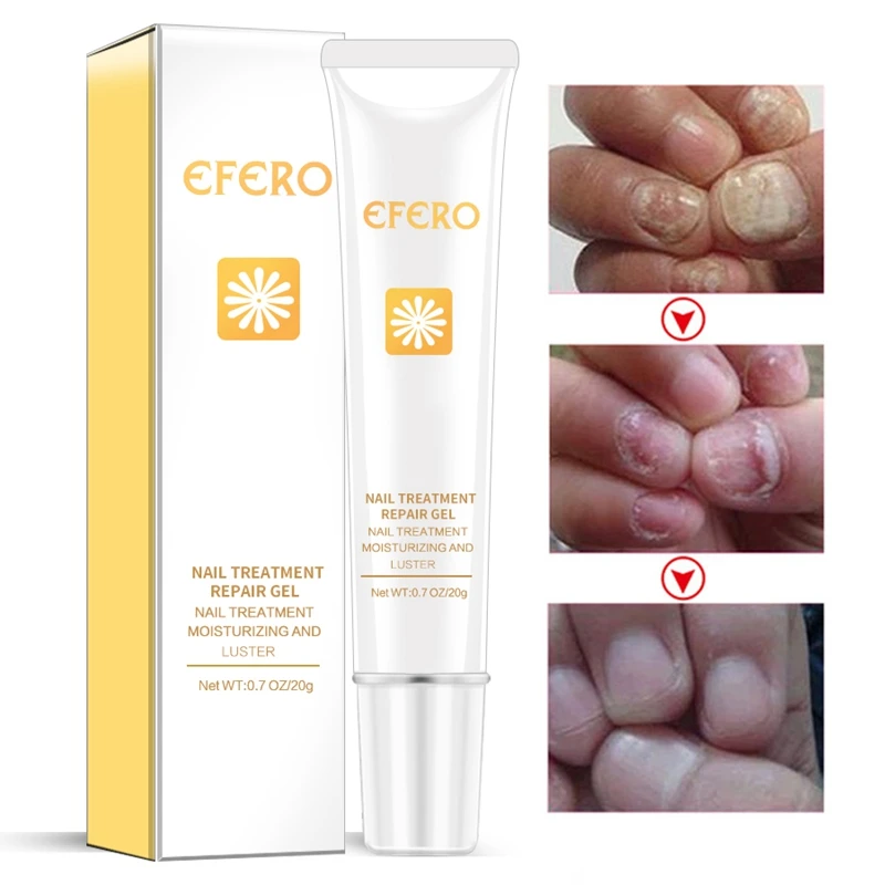 On sale Offer of  Efero Fungal Nail Treatment Feet Care Essence Whitening Toe Nail Fungus Removal Gel Anti Infection 