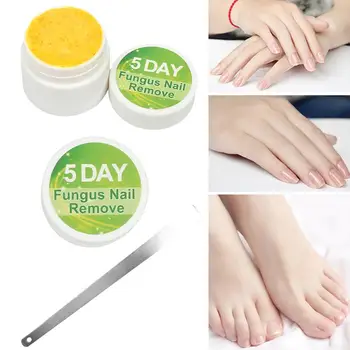 

Onychomycosis Repair Cream Toe Nail Fungus Treatment Anti Fungal Nail Infection Essence Nail Treatment Removal Nail Care Lotion