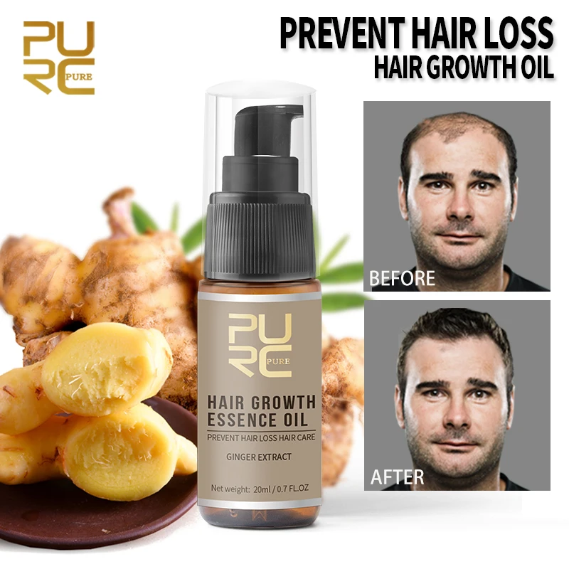

PURC Ginger Hair Essence Oil Anti Hair Loss Product Prevent Baldness Effectively Promote Hair Growth Strengthen Hair Roots 20ml