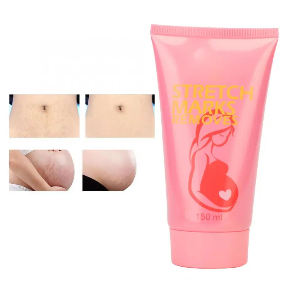 Postpartum Scar Diluting Repairing Cream Stretch Marks Obesity Pattern Remover Obesity Pattern Removal Cream