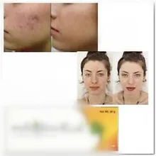 Импорт 0.12% 40% экстракт лакрицы никотиamарбутин антиоксидант Осветляющий акне 20 г