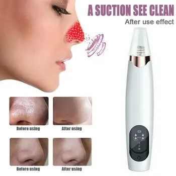 

Black Point Vacuum Black Dots Vacuum Pore Cleaner Nose Remover Pimple Suction Extractor Removal Point Black Acne Blackhead M4N6
