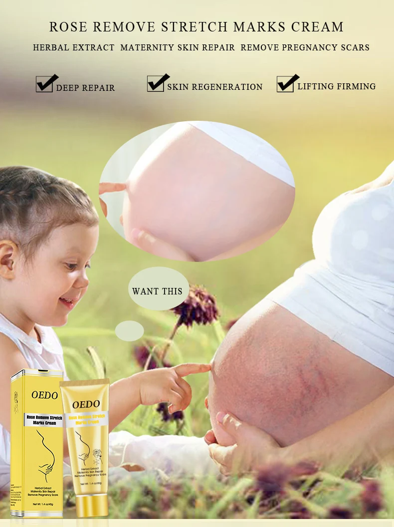 oedo stretch mark cream price