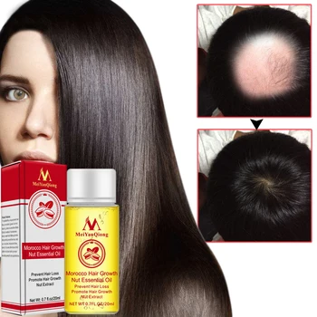 

Effective Anti-off Nut Extract Essential Oil Lasting Nourishing Repair Damage Hair Roots Fast Growth Hair Loss Treatment TSLM1