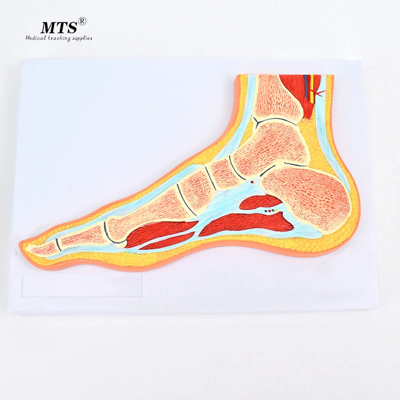 Medical Foot Joint Skeletal Muscle Model Ankle Foot Orthopedic Joint Structure Mri Teaching Medical Science Aliexpress