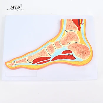 

Medical Foot Joint Skeletal Muscle Model Ankle Foot Orthopedic Joint Structure MRI Teaching