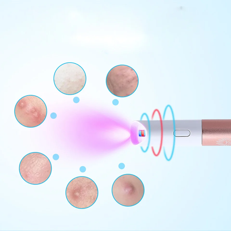 

Light LED Acne Removal Instrument Red and Blue Light Desalination Acne Removal Print Acne Removal Pen Beauty Instrument