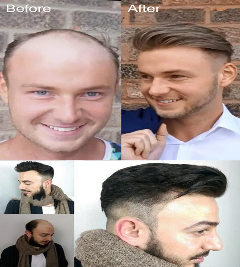 Peruca de Cabelo Humano para Homem Peças de Cabelo Europeu para Homem com 10 Bymc Humano Laço Francês Super Fino 1b Fora Preto x 8 7 # 1b fora preto