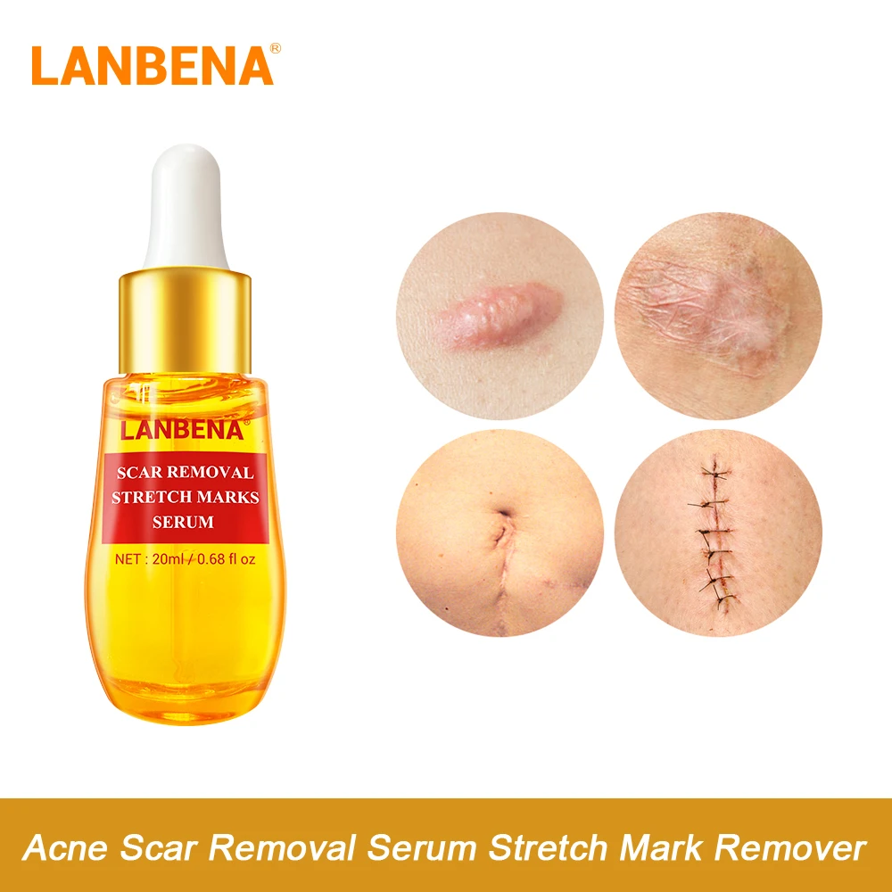 serum for scar treatment