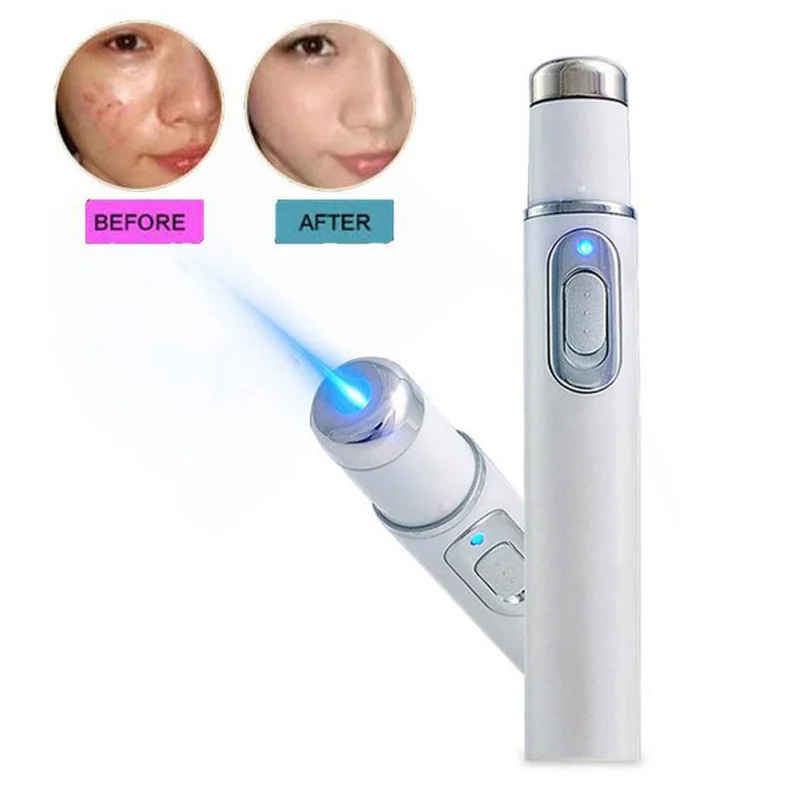 Blue Light Therapy Acne Laser Pen portable Scar Wrinkle Removal Treatment Acne Laser Pen skin care tool 4