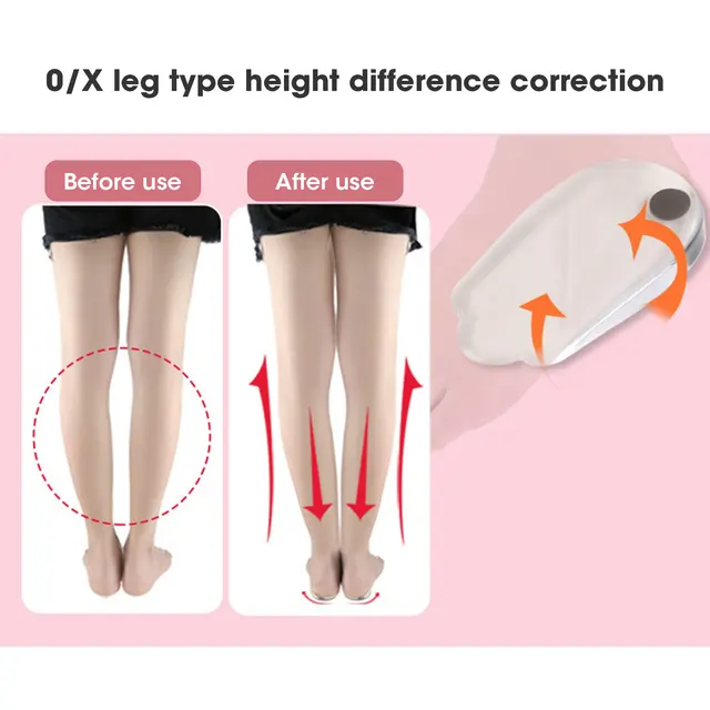 2PCS Insoles Correction Shoe Inserts Pads Effective O/X Type Leg Bowed