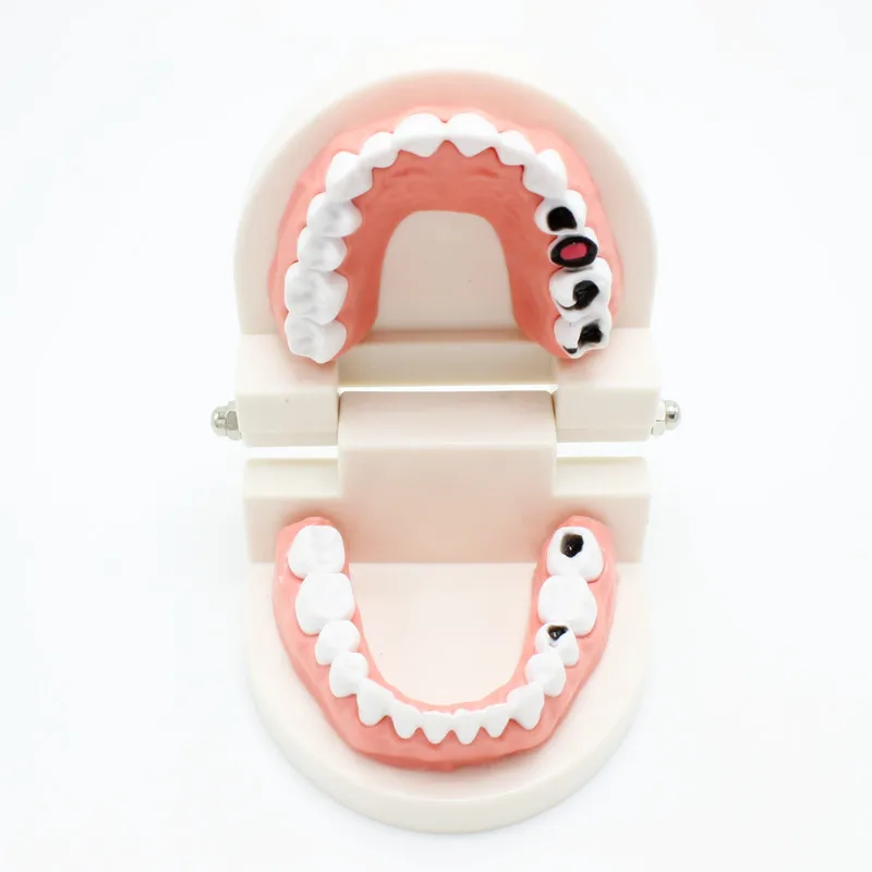 

Standard Study Model Big Teeth Model Dental Dentist Tooth Model Disease Teeth Medical Teaching Tool Art Tools Education Tools