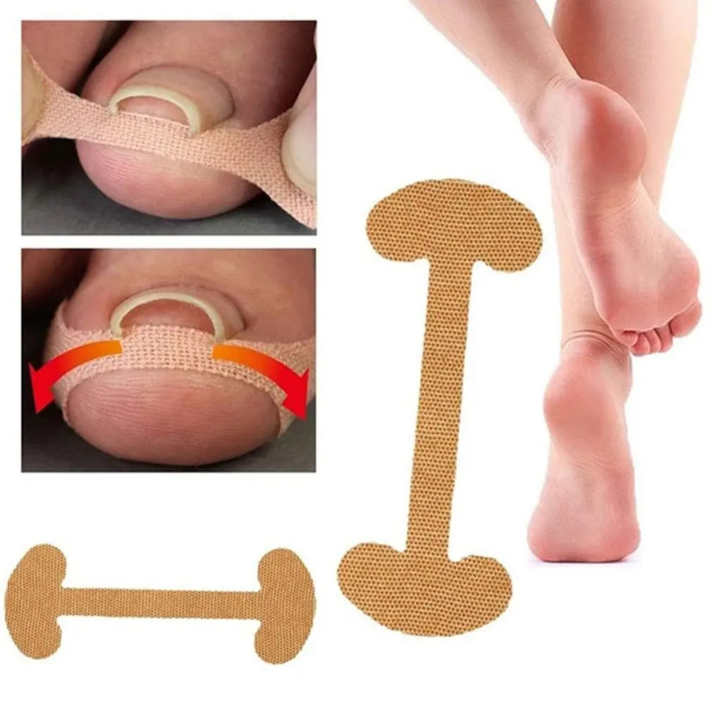 

Toe Nail Corrector Toenail Nail Groove Inlay Toe Nail Correction Nail Patch Quick To Correct Toe Nail Deformation