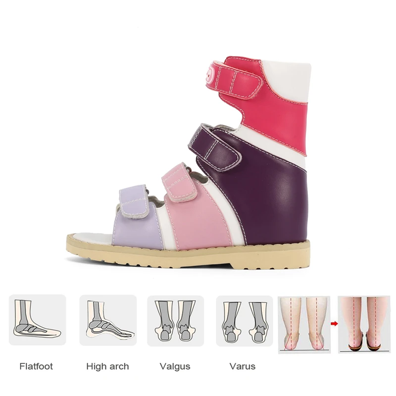 Girls Summer Sandals Kids Orthopedic High Ankle Clubfoot Shoes Children Boys Cute Treatment Footwear With Arch Support Insole Sandals Aliexpress Girls Summer Sandals Kids Orthopedic High Ankle Clubfoot Shoes Children Boys Cute Treatment Footwear With Arch Support Insole Sandals Aliexpress