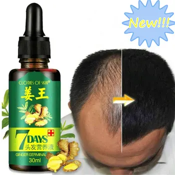 

Hair Care Treatment Ginger Hair Nutrition Fast Hair Growth Remedy Essence Oil Loss Treatement Hair Regrowth Products