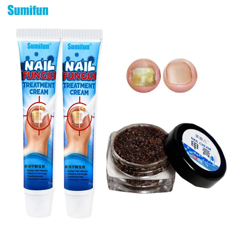 

Sumifun 2 Types of Fungal Nail Treatment Fungal Cream Antibacterial Repair Ointment Whitening Toe Anti Infection Nail Repair