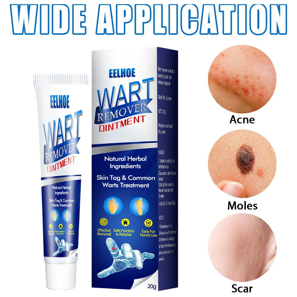 New Effective Wart Treatment Face/Foot Cream Instant Blemish Removal Gel Body Skin Tag Beauty Health Care Tool |