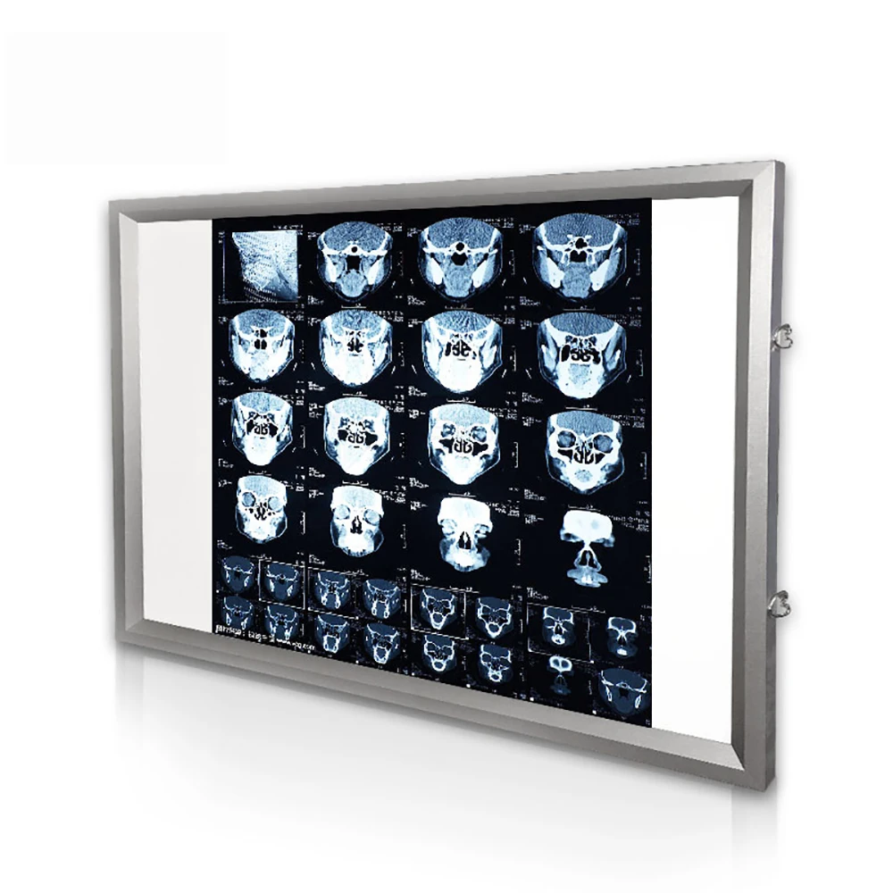 

Hospital X-ray Viewing Lamp Dental Orthopaedic Manual Control X-Ray Film Illuminator Light Box X-ray Viewer