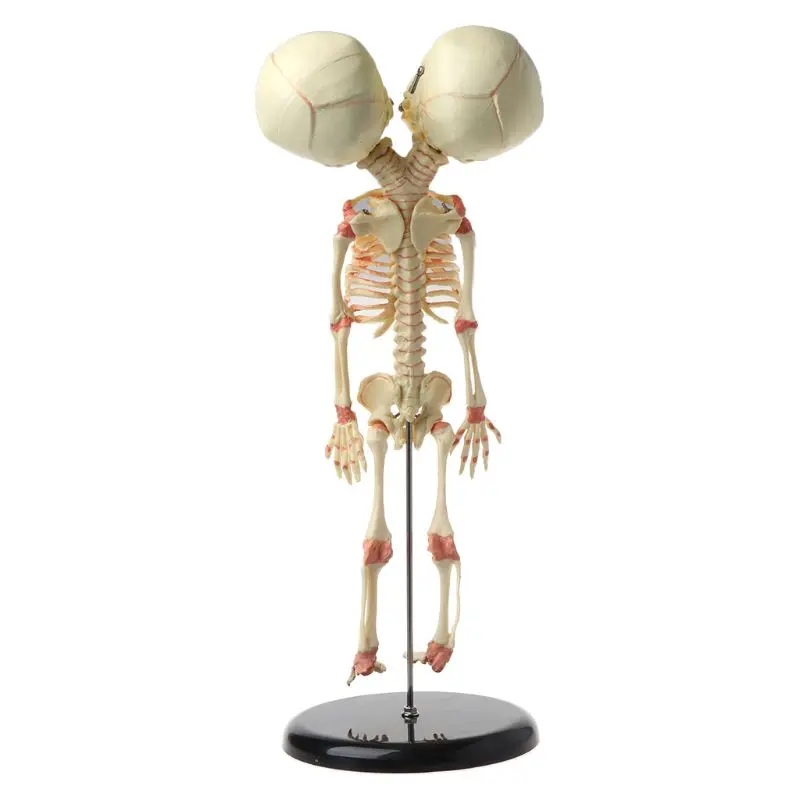 37cm Human Double Head Baby Skull Skeleton Anatomy Brain Display Study Teaching Anatomical Model