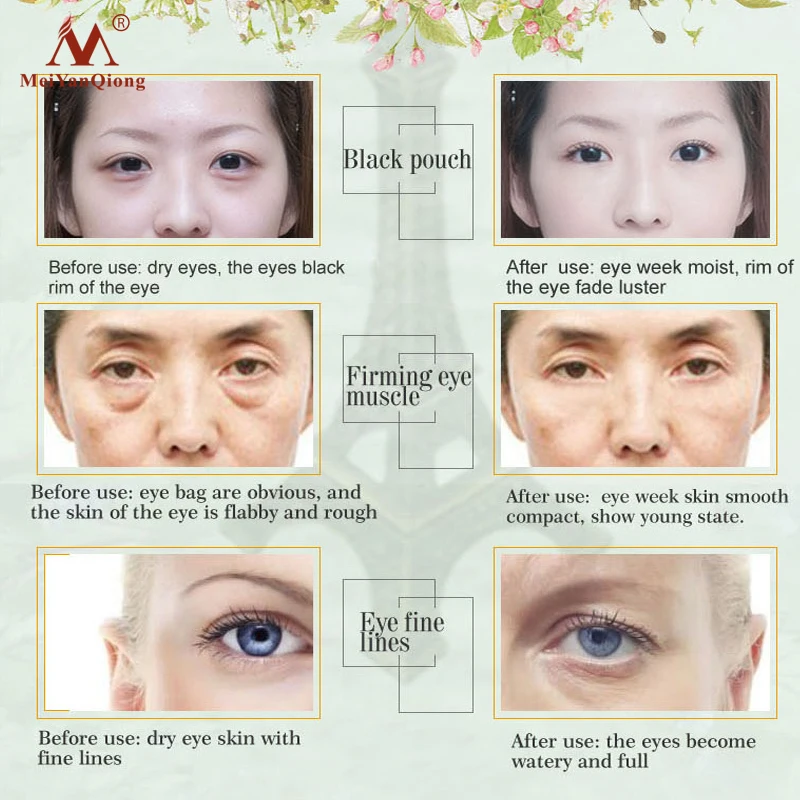 shea butter for under eyes