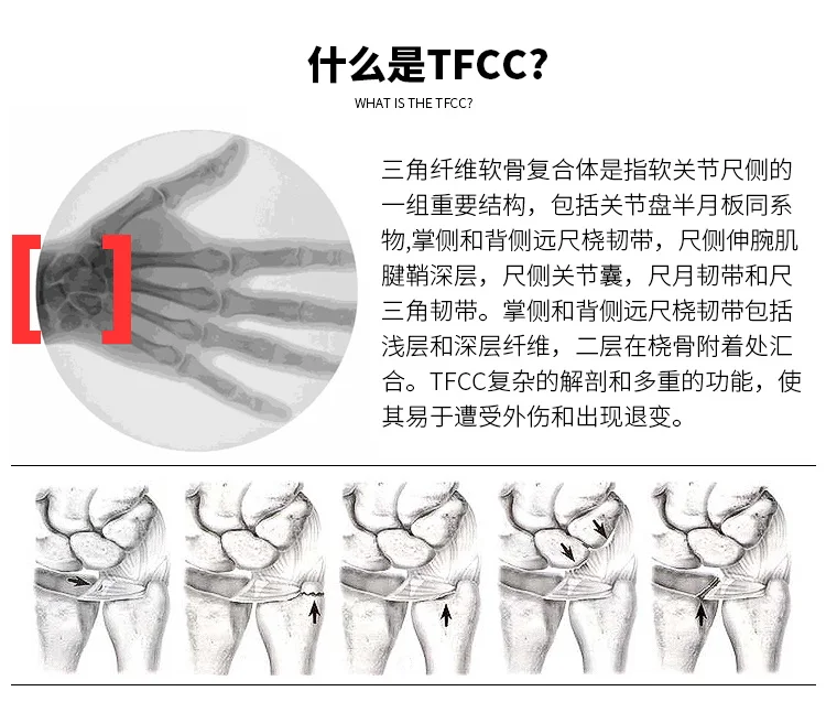 Импортный браслет для мужчин и женщин для йоги, фитнеса, спорта TFCC, анти-растяжение, ремешок на руку