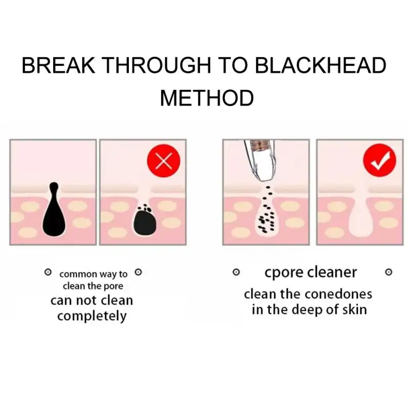 Электрический Очиститель угрей батарея лица пор красота устройство устранения